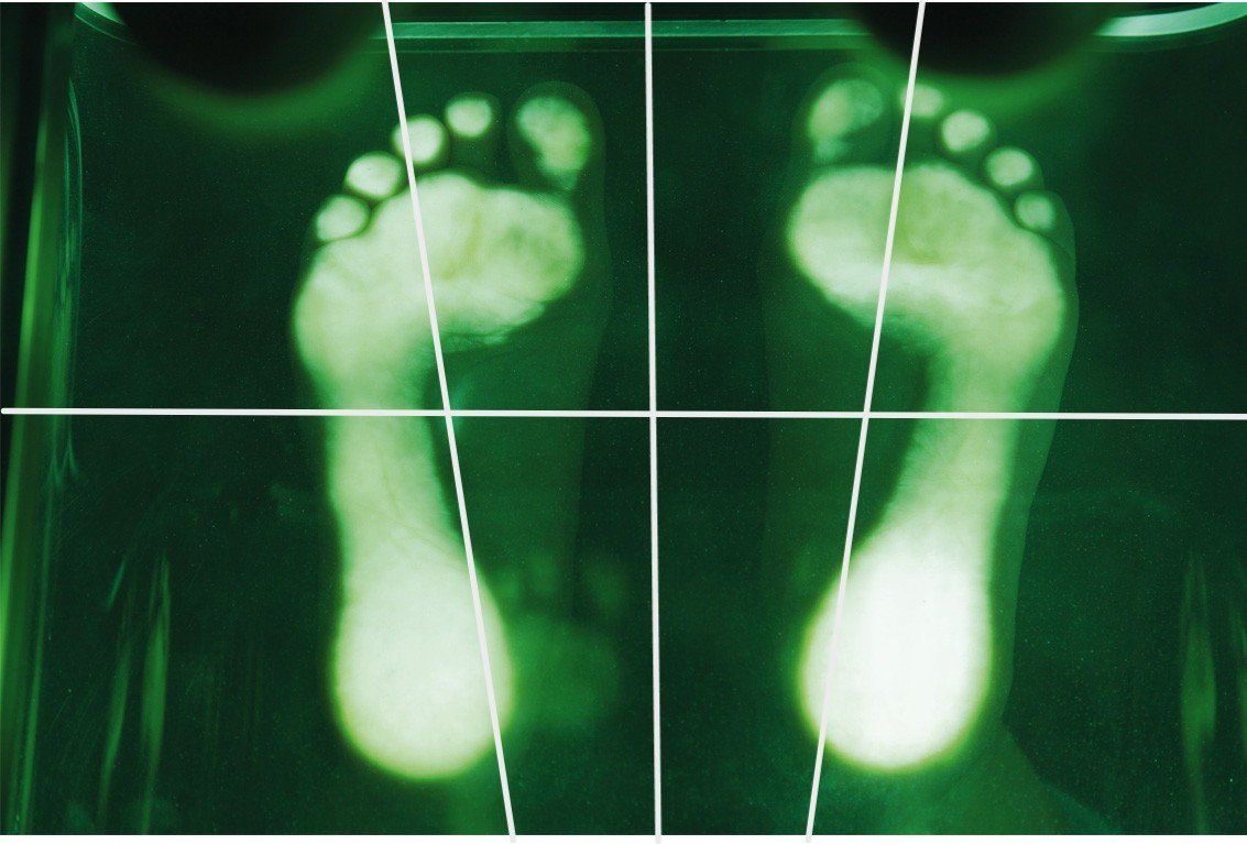 Attrezzature mediche: PODOSCOPIO DATA LUX A LED RGB – Nuovo (secondo la descrizione) da Porza venduto da alba55 2