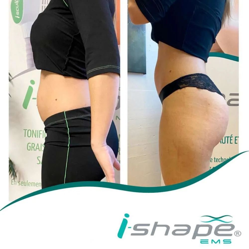 Appareils de massage: i-model esthetic  – Neuf (Voir description) à Frauenfeld par ren_8xzb 8