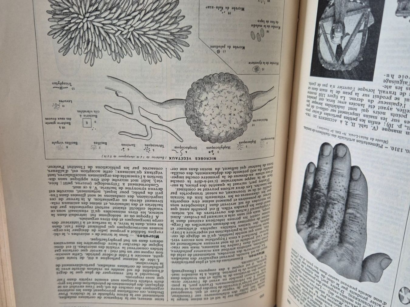 Libri: Larousse Médical Illustré - Edition Ancienne – Usato da Fully venduto da tameab 3
