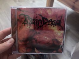 Braindead (death metal)