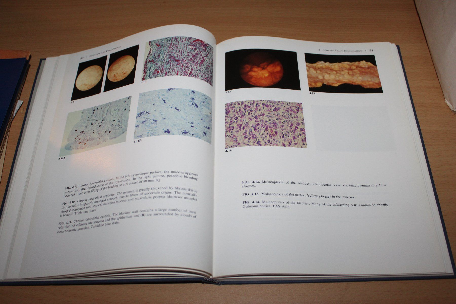 Bücher: Urinary Tract Pathology: An Illustrated Practical Guide – Gebraucht aus Kaden von Buchantiquariat 4