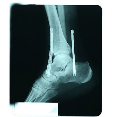 Protezioni & Imbottiture: Müller Ankle Soccer Brace Gr. XL – Nuovo e nell'imballaggio originale da Spreitenbach venduto da Opfikoner1 1