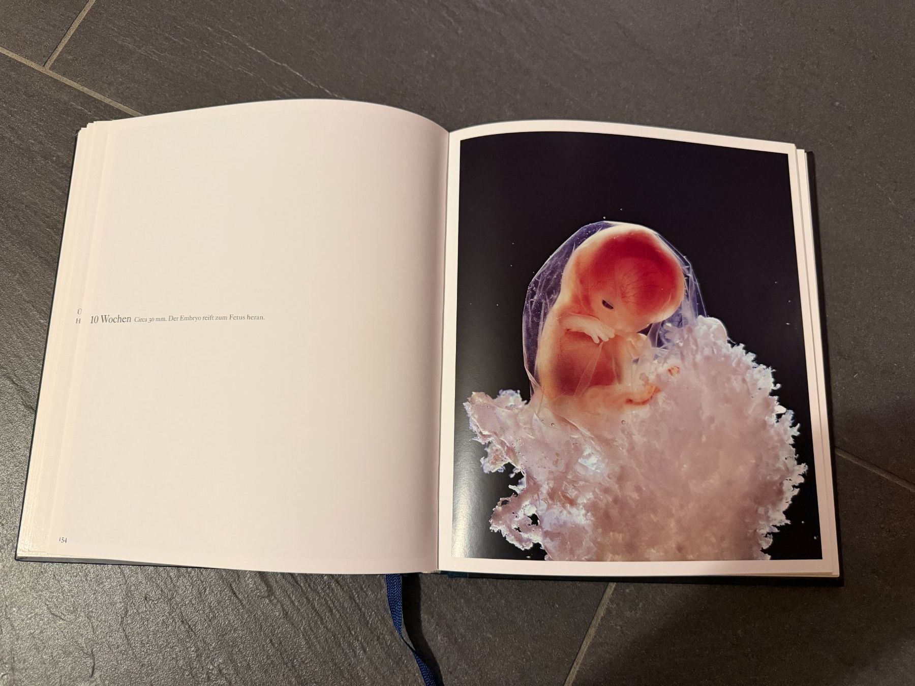 Livres: Lennart Nilsson, Ein Kind Entsteht – D'occasion à Niedermuhlern par ste_c5h9 2