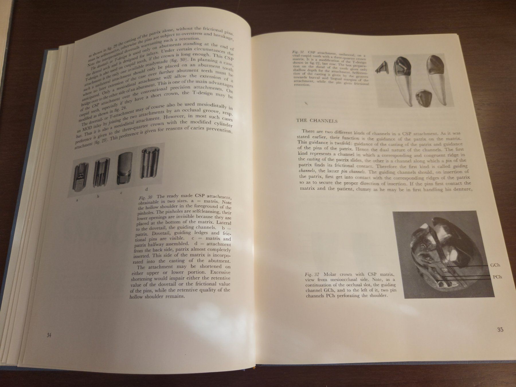 Libri: Steiger/Boitel – Partial Dentures 1959 – Widmung – Usato da Aldesago venduto da lusuardi 8