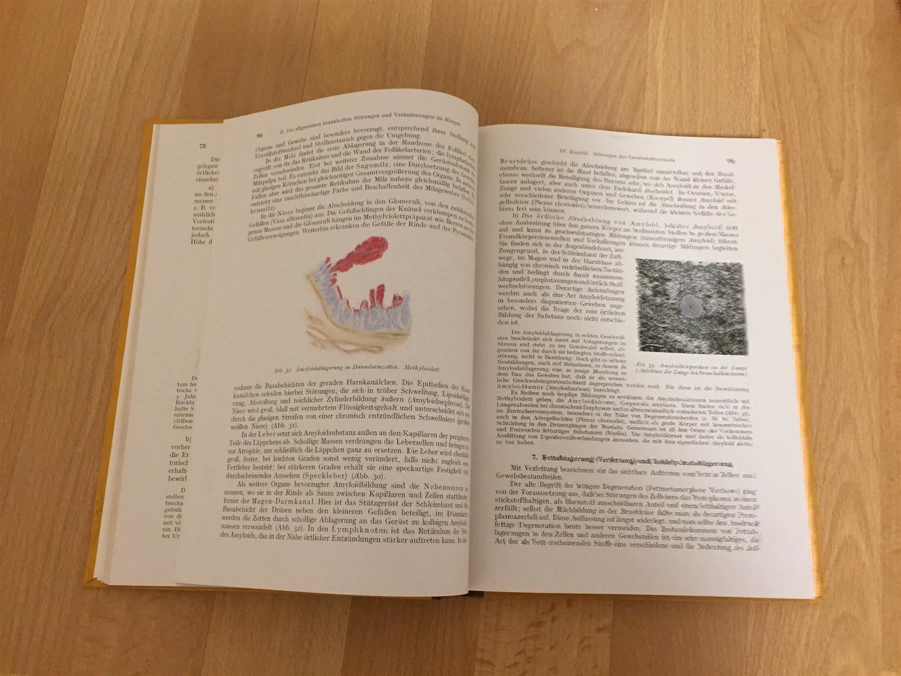 Bücher: A. Dietrich. «Allgemeine Pathologie und – Gebraucht aus Cormagens von Bonsai111 5