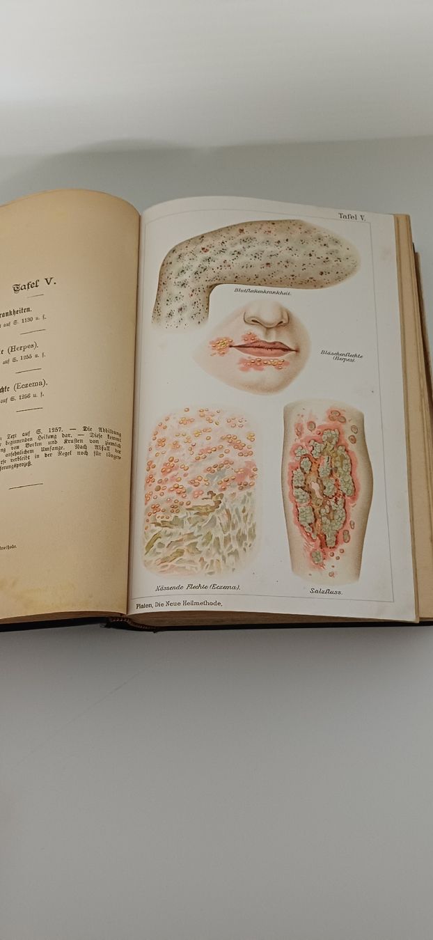 Appareils médicaux: 2 Bücher Neue Heilmethoden Platen  – D'occasion à Grosswangen par Geschenkberatung 2