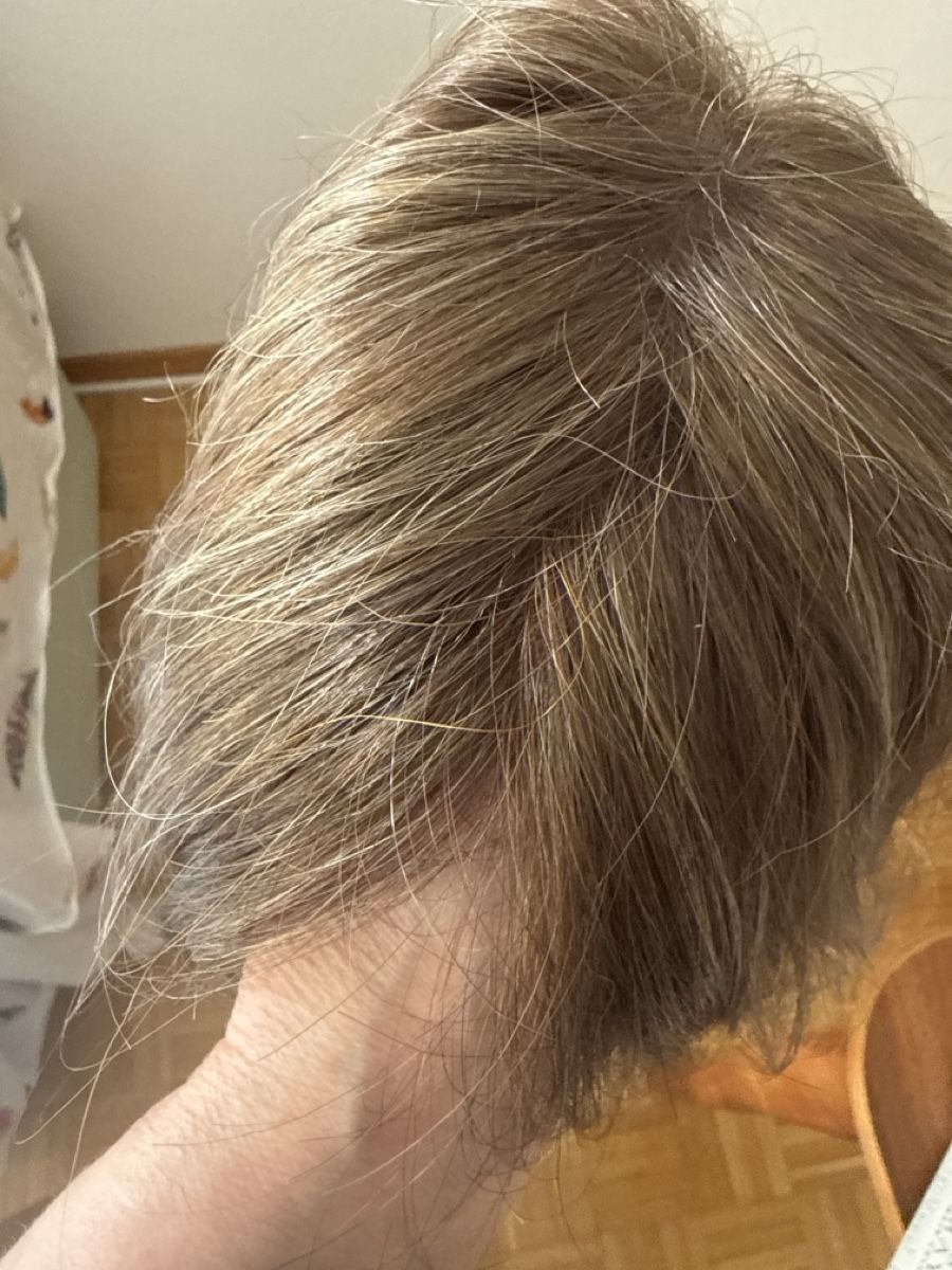 Perücken: Perücke Gisela Mayer – Neu und originalverpackt aus Winterthur von Ehsie 3