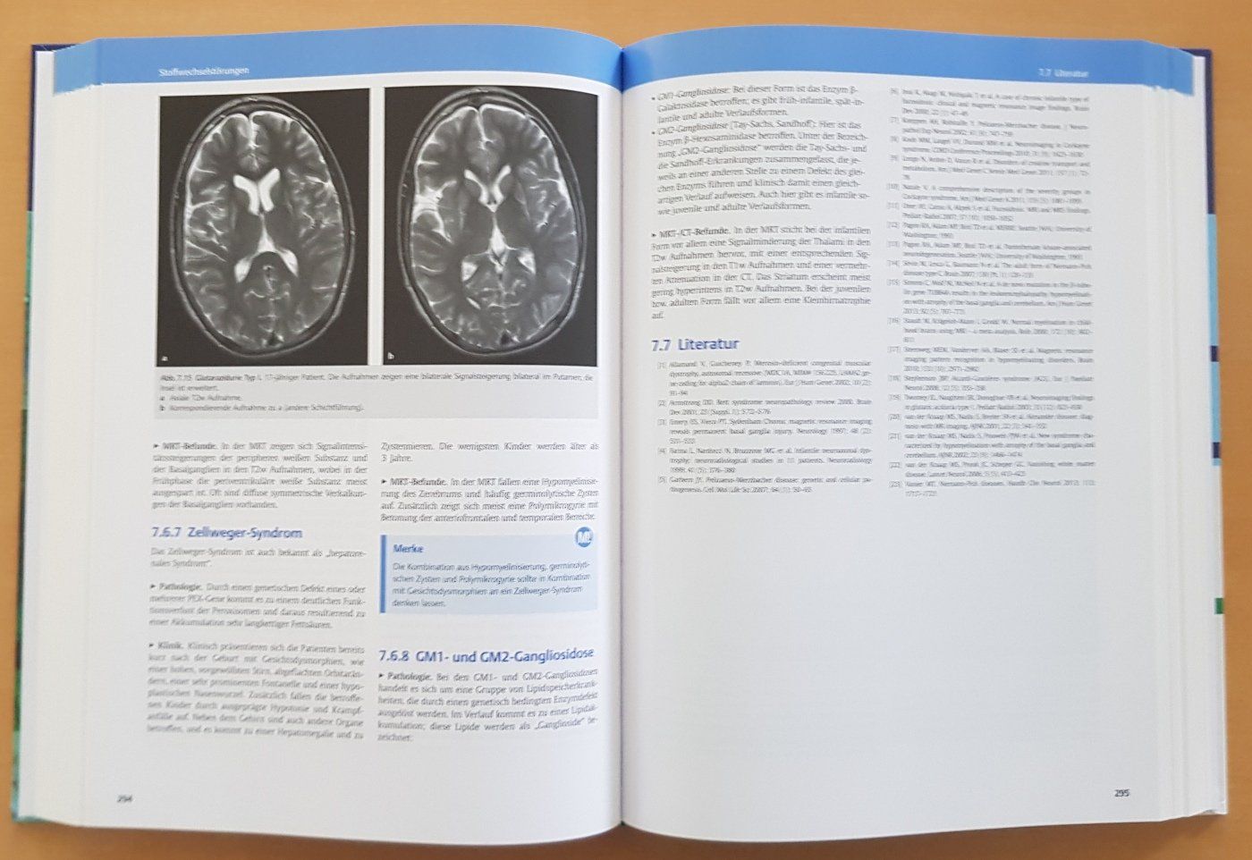 Libri: Sachbuch "MRT des Zentralnervensystems" – Usato da Schaffhausen venduto da asyouwestley 2