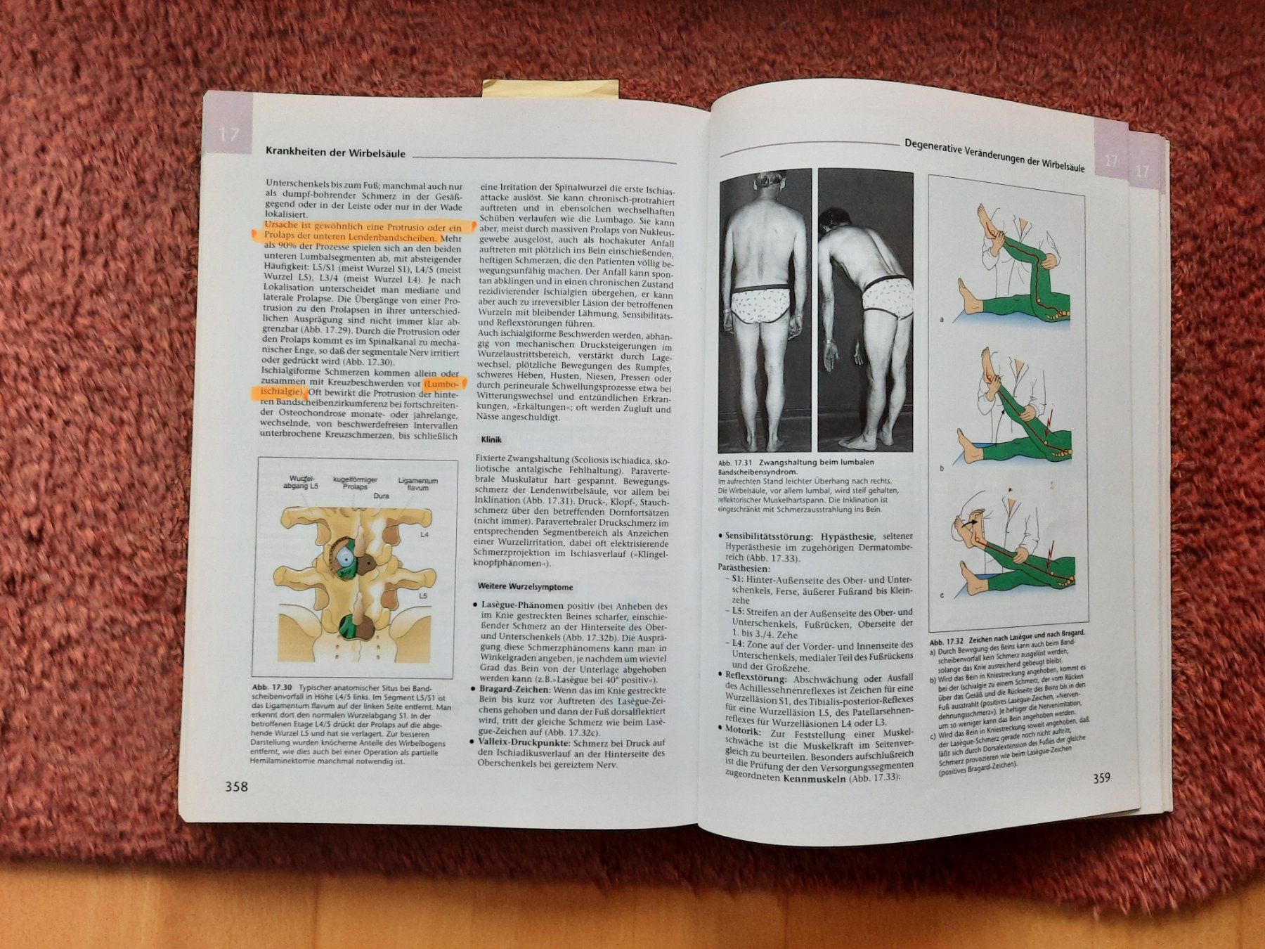 Libri: Orthopädie Rössler/Rüther - 18. Auflage – Usato da Niederrohrdorf venduto da Sweetcat 1