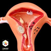 📌 NEU Gebärmutter Anatomisches Modell