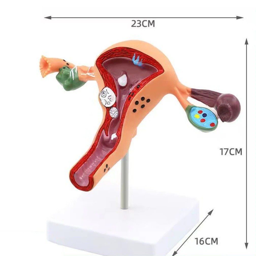 Modellbausätze & Standmodelle: 📌 NEU Gebärmutter Anatomisches Modell – Neu und originalverpackt aus Wittenbach von ChinaSeidenstrasse 3