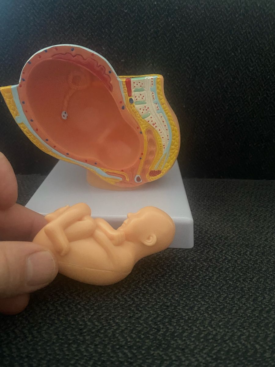 Kit di modellismo & Modellini statici: Anatomie Modell: Gebärmutter mit Fötus - Top Zustand! – Nuovo (secondo la descrizione) da Berikon venduto da Samurai67ch 3