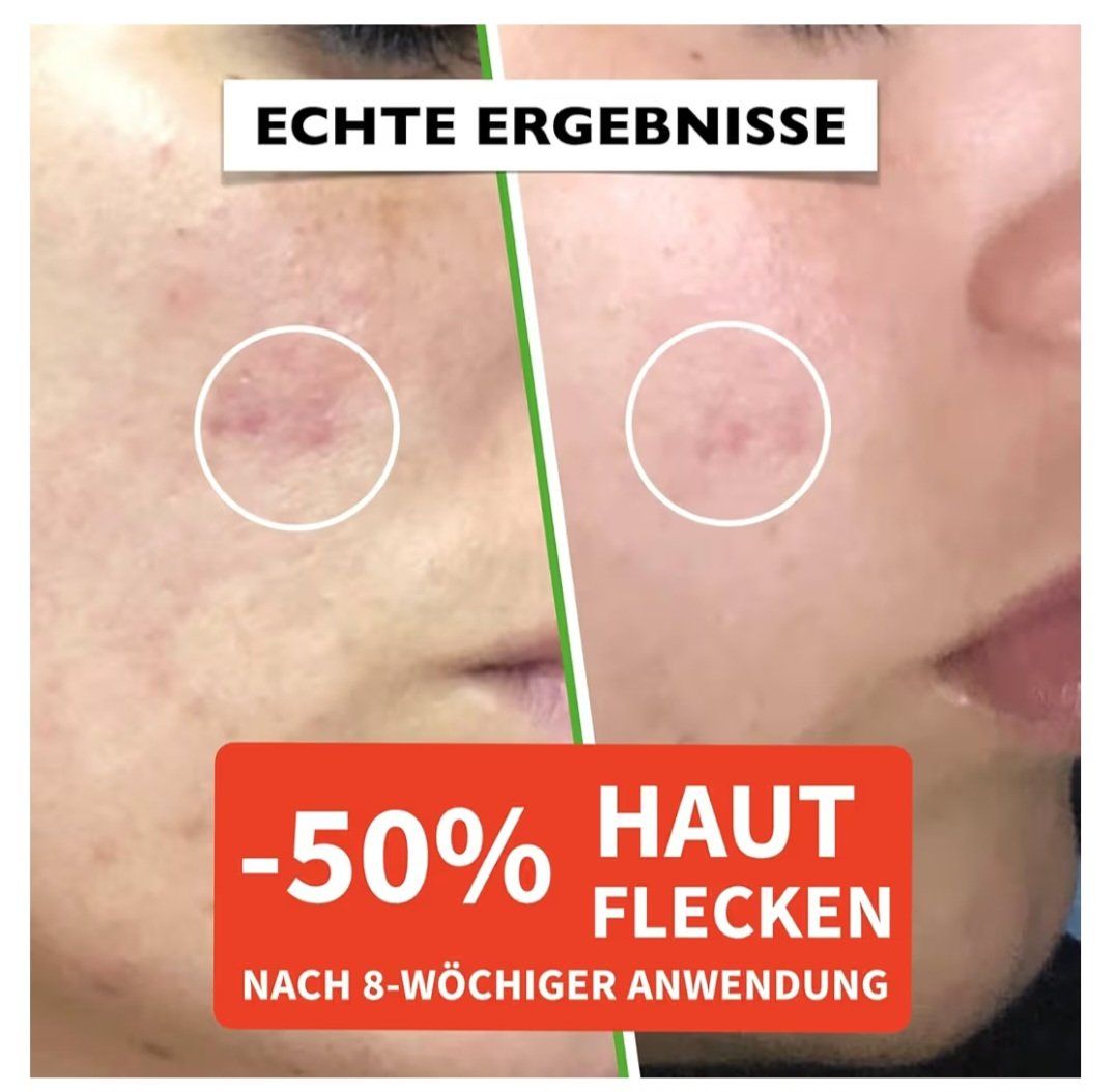 Cura del viso: Hyaluron-Serum mit Vitamin C & E 60ml – Nuovo e nell'imballaggio originale da Zürich venduto da Simple23 2