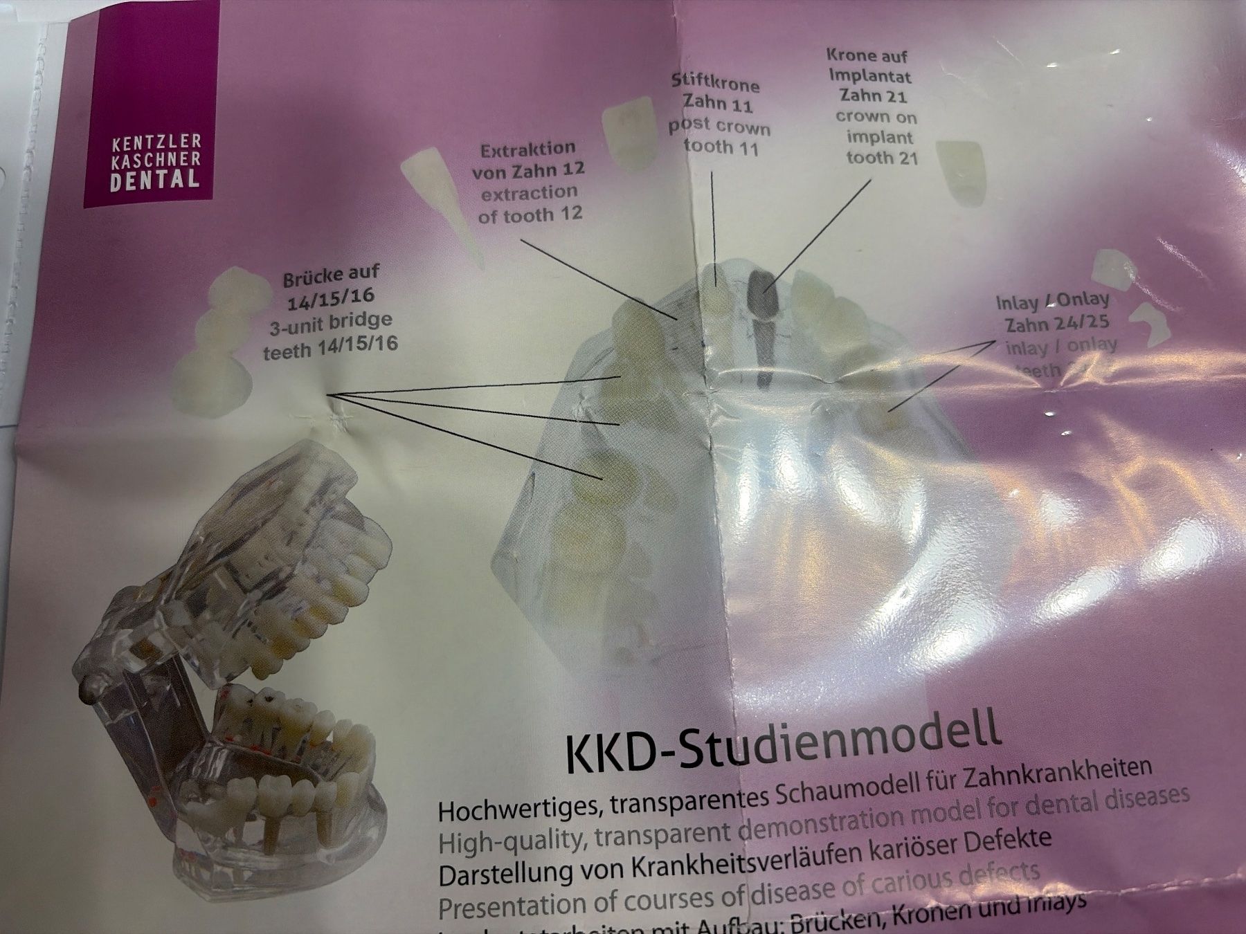 Soins dentaires: KKD Studien Modell REF 9445 Zahnmodel – Neuf avec emballage d'origine à Uster par oranger_pulli 7