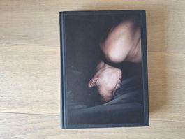 Antoine d'Agata : Anticorps