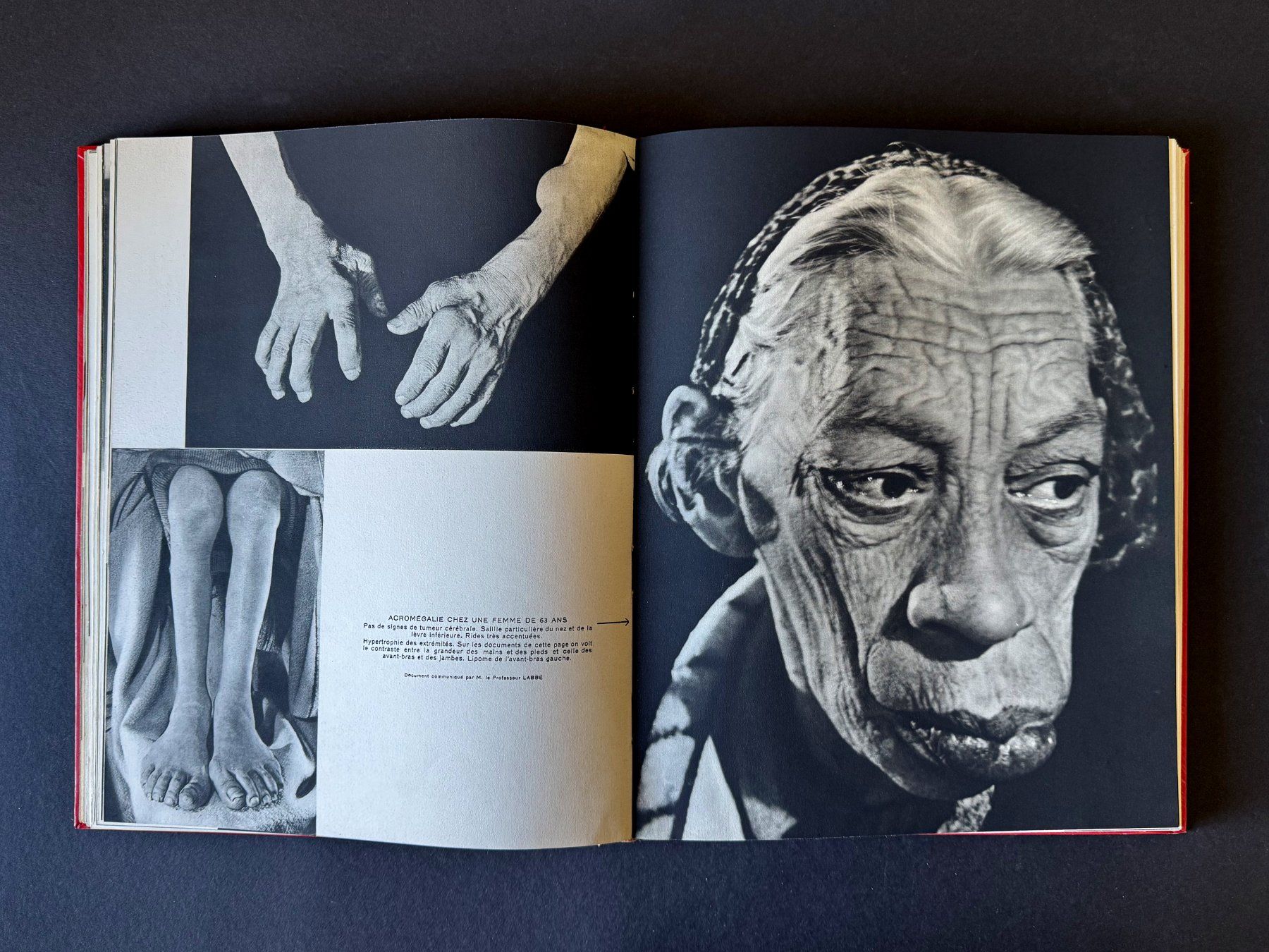 Libri: La collection des Documents Médicaux. Robert Lang. Paris. – Usato da Zürich venduto da Tulsa1968 6