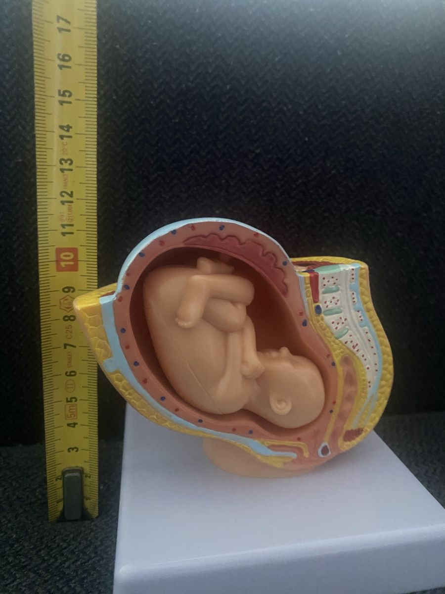 Kit di modellismo & Modellini statici: Anatomie Modell: Gebärmutter mit Fötus - Top Zustand! – Nuovo (secondo la descrizione) da Berikon venduto da Samurai67ch 5