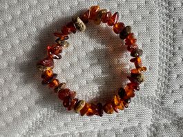 Kleine Bernstein-Armkette