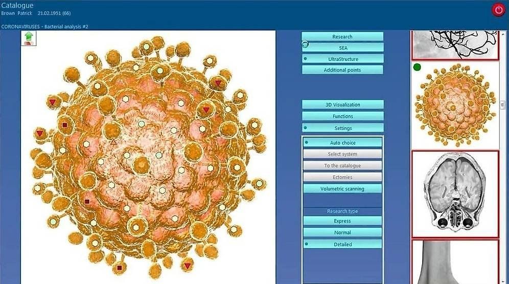Attrezzature mediche: METATRON INTRUDER NLS ANALYSE SYSTEM mit Wartungsservice – Usato da Neuchâtel venduto da Roxy_777 1