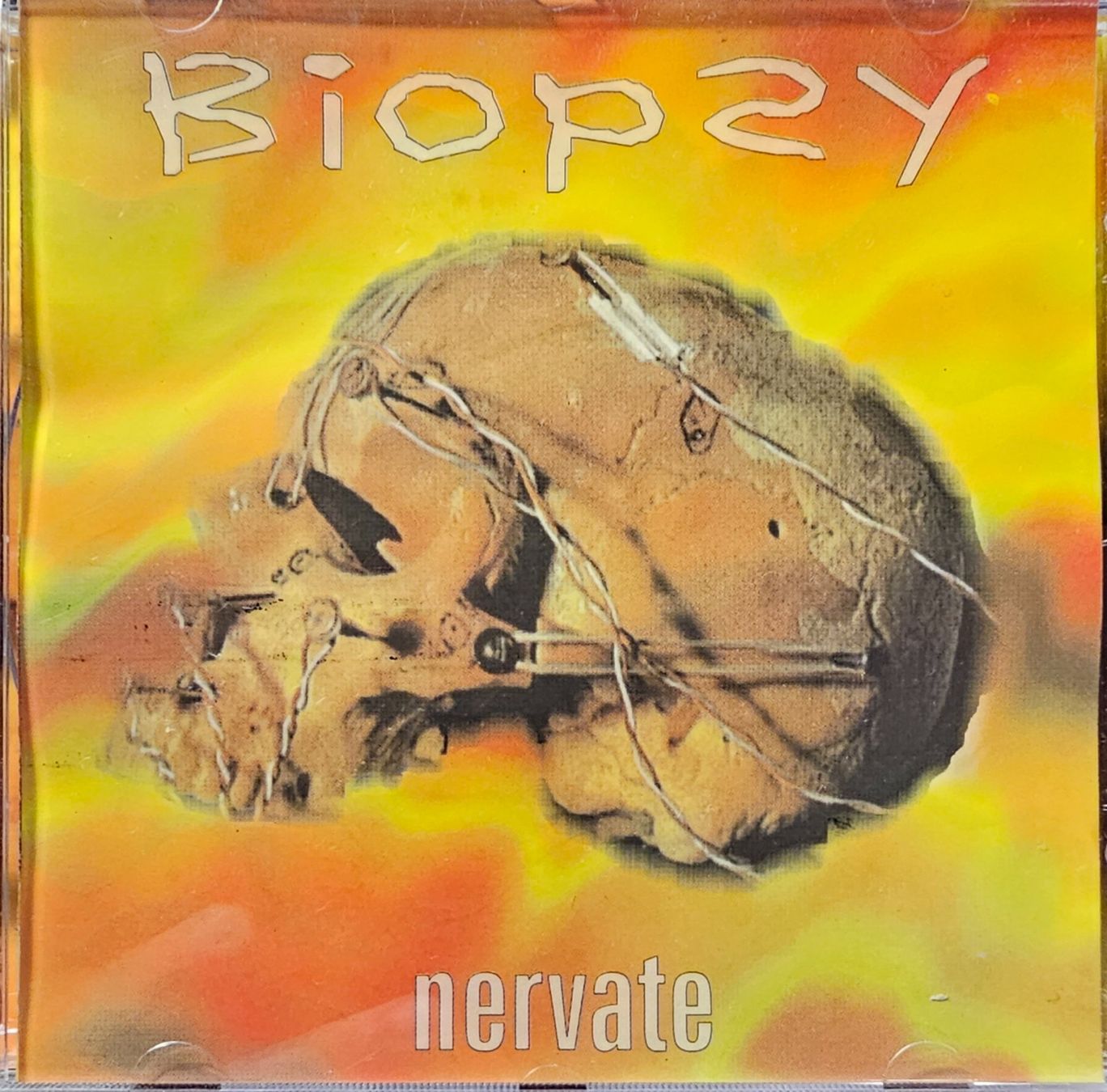 CDs: Biopsy ‎– Nervate – Gebraucht aus Wahlen b. Laufen von Cg10