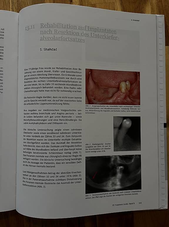 Libri: ITI Treatment Guide Band 9 Deutsch – Usato da Neuhausen am Rheinfall venduto da ram_kw6n 2