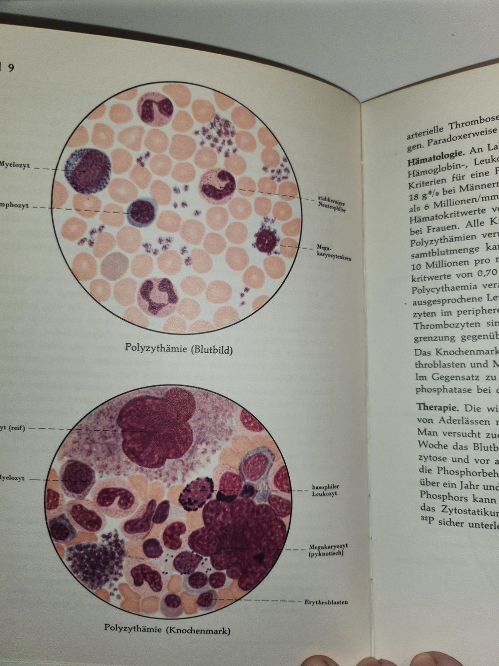 Libri: Tabulae haematologicae - Hämatologie Bildatlas – Usato da Dietikon venduto da Buchantiqdietikon