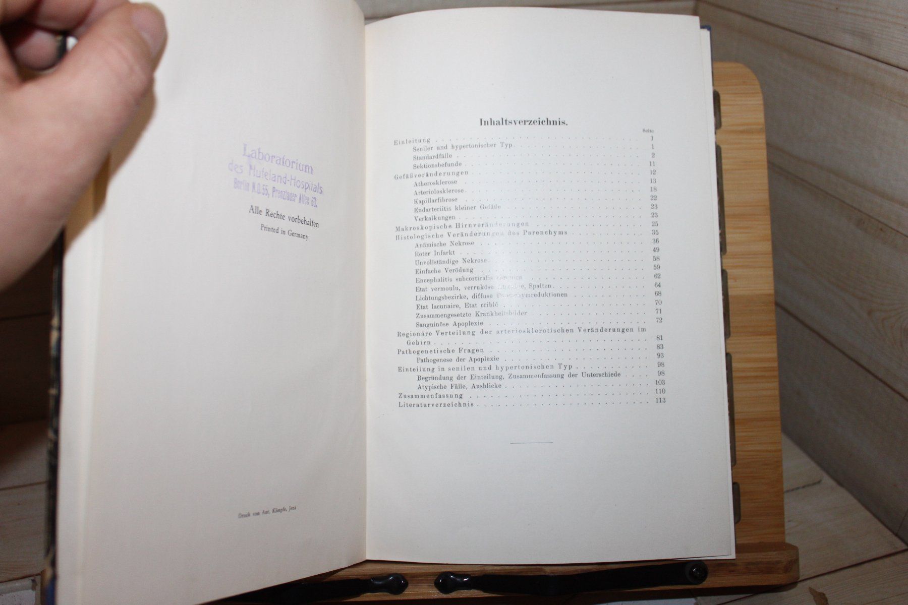 Libri: Beiträge zur Histologie, Pathogenese und Einteilung – Usato da Kaden venduto da Buchantiquariat 2