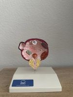 Anatomiemodell Blase/Prostata – urologische Krankheitsbilder