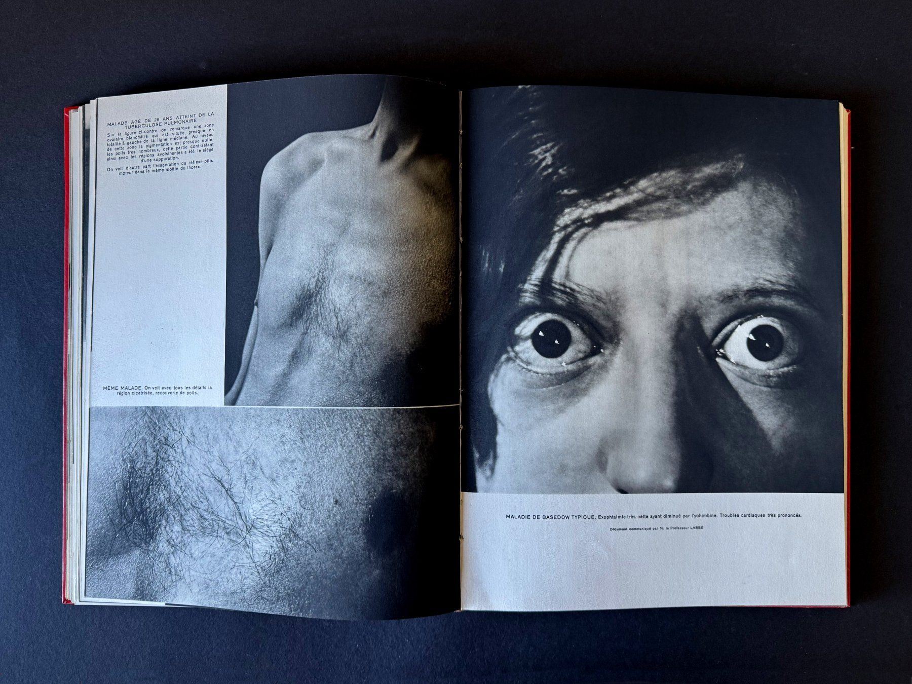 Libri: La collection des Documents Médicaux. Robert Lang. Paris. – Usato da Zürich venduto da Tulsa1968 3