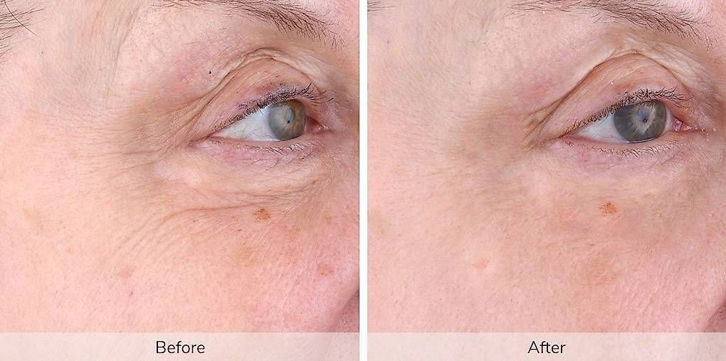 Gesichtspflege: Ivory by Elevare Skin  – Gebraucht aus Tentlingen von Sunshine1734 1