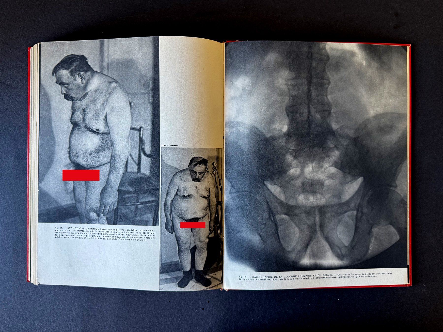 Libri: La collection des Documents Médicaux. Robert Lang. Paris. – Usato da Zürich venduto da Tulsa1968 9