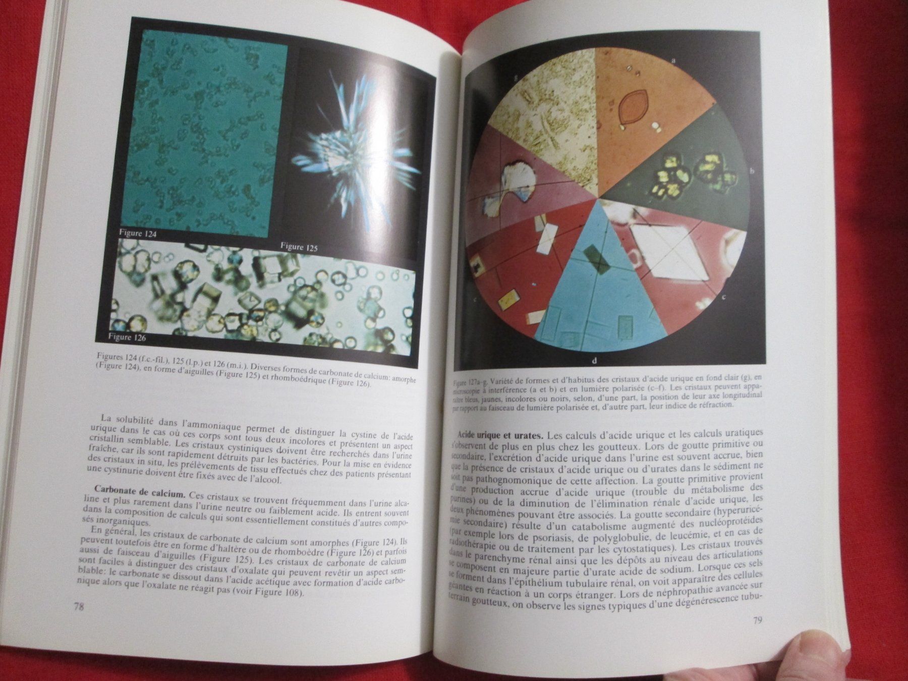 Libri: L'urine vue au microscope – Usato da Neuchâtel venduto da Dualseele 7