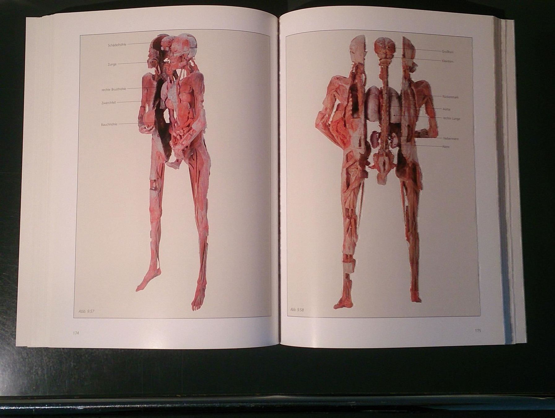 Libri: Körperwelten-Katalog  Ausstellung 1999 – Usato da Dübendorf venduto da Povo 6