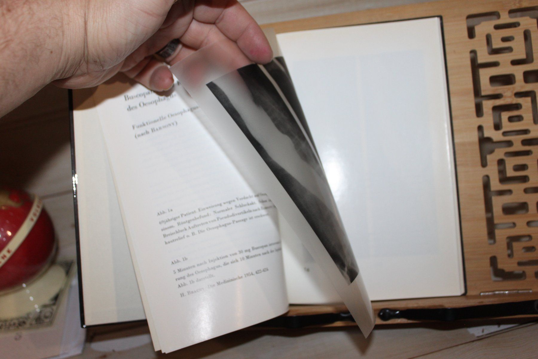 Libri: Spasmolyse im Röntgenbild – Usato da Kaden venduto da Buchantiquariat 2