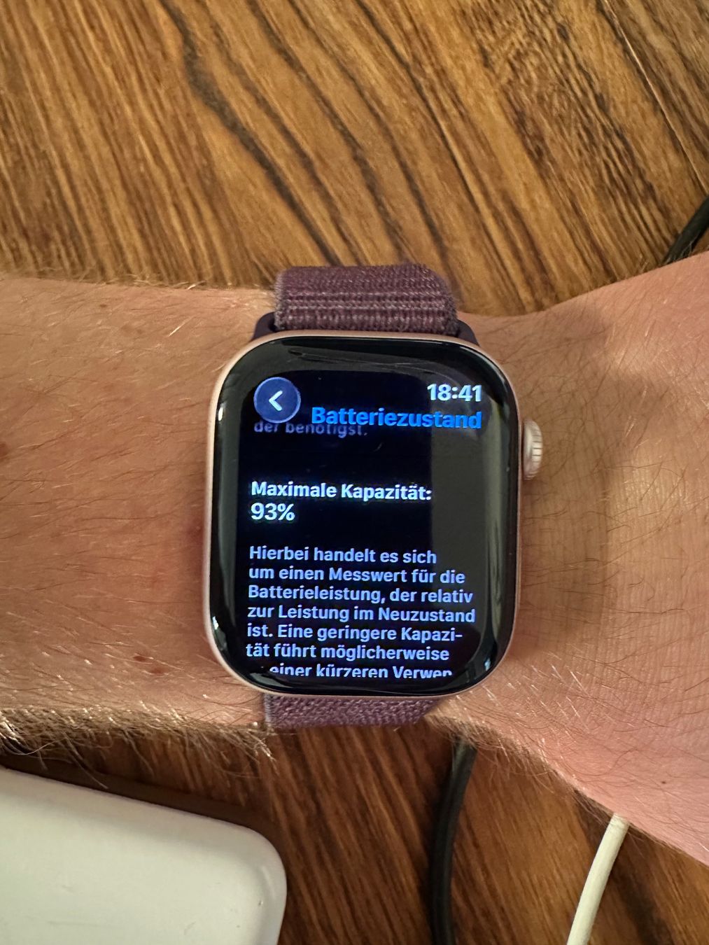 Apple Smartwatch: Apple Watch series 10 Aluminium Case GPS – Nuovo (secondo la descrizione) da riehen venduto da ton_6f6c 4