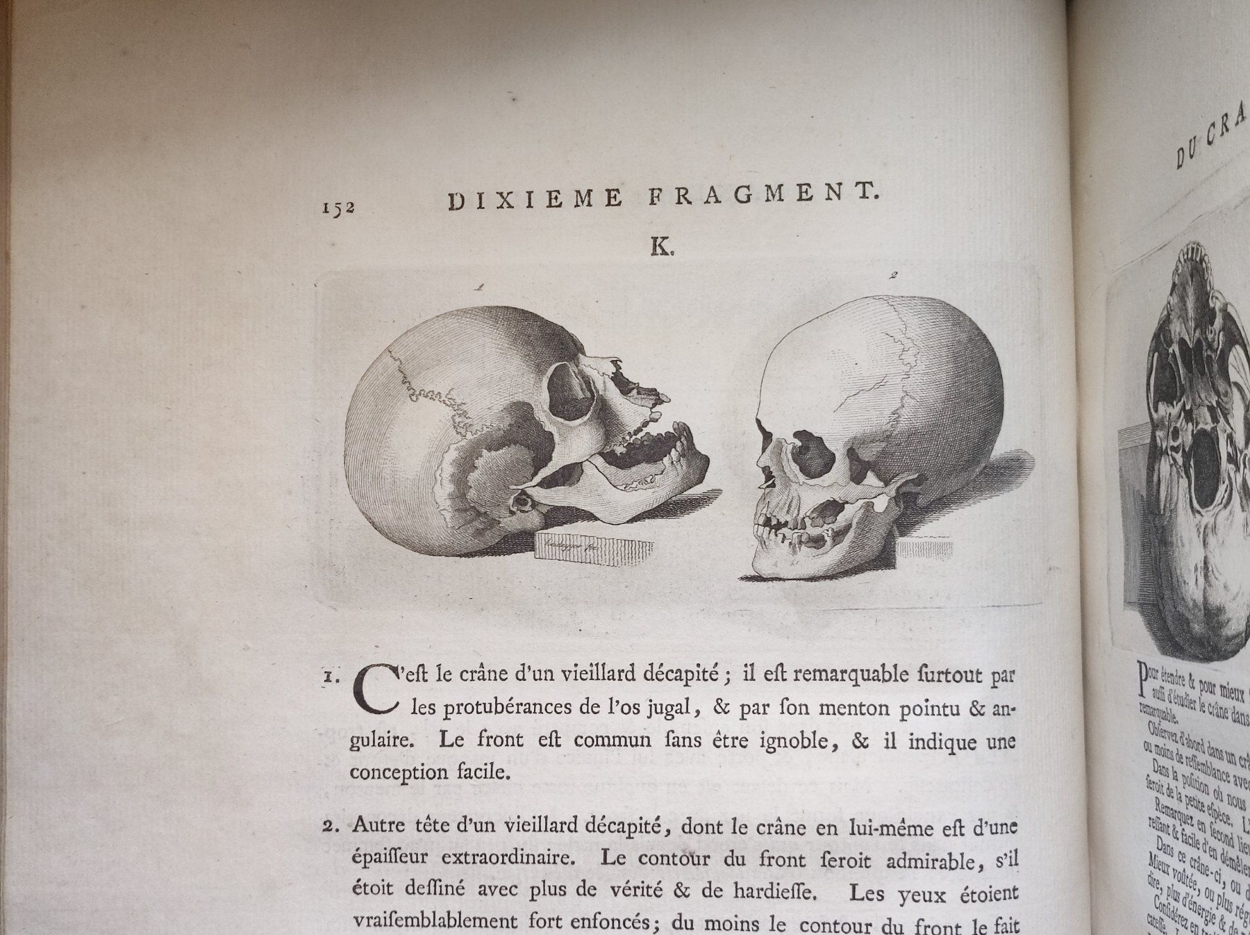 Libri: MEDIZIN - ANATOMIE - PHYSIOGNOMIE - – Usato da Goldach venduto da Gaip 6
