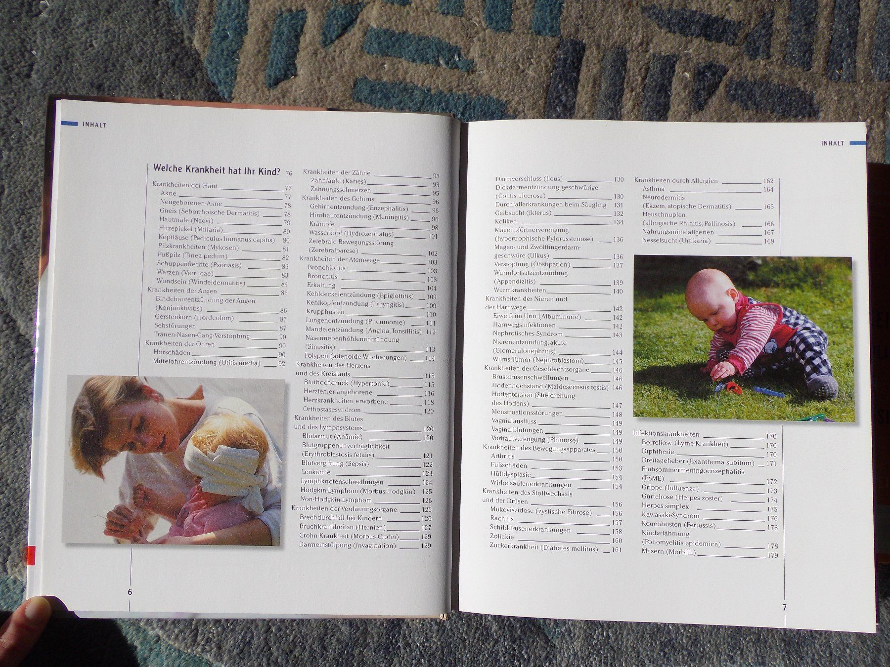 Libri: Rat und Hilfe bei Kinderkrankheiten – Usato da Uster venduto da urs_75by 3