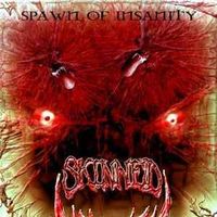 Skinned ‎– Spawn Of Insanity
