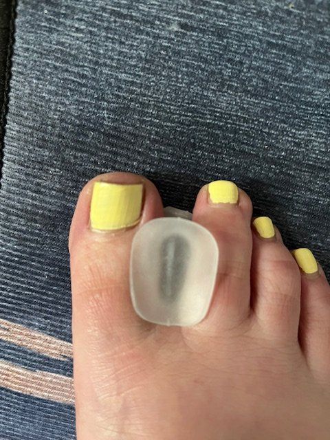 Pedicure: Zehenspreizer G mittel – Nuovo (secondo la descrizione) da Nottwil venduto da Frontal 5
