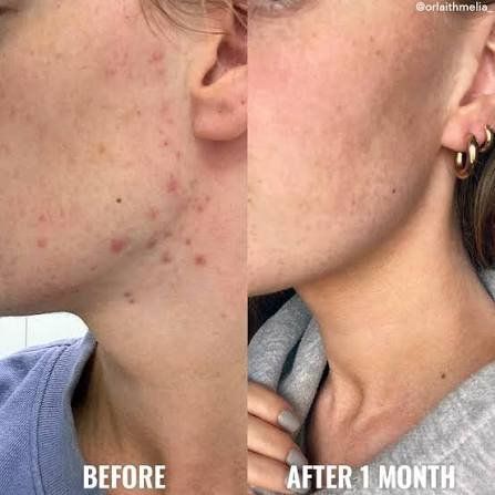 Cura del viso: Good Molecules Niacinamide Texture & Pore Refining Set – Nuovo e nell'imballaggio originale da Cham venduto da Trendy_Outlet 5