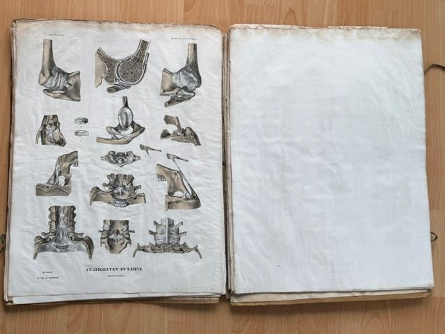 Grafiken & Lithographien: Zwei Lithographien "Tabula Anatomicae" v. Frederici Arnoldi – Gebraucht aus Lostorf von Nick1258 5