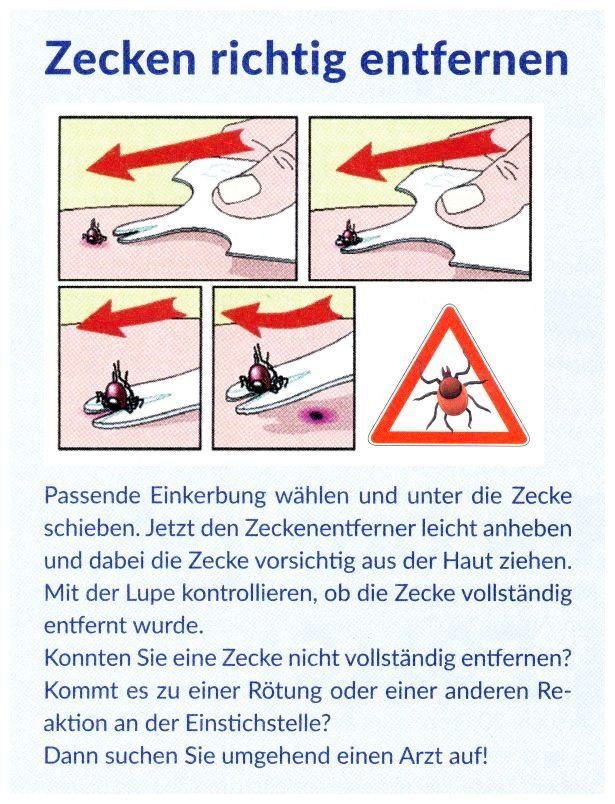 Tutti gli attrezzi: Zeckenentferner mit Lupe aus Kunststoff – Nuovo (secondo la descrizione) da Windisch venduto da Vindonissa07 1