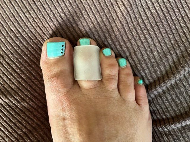Pedicure: Zehenschutzring G mittel... – Nuovo (secondo la descrizione) da Nottwil venduto da Frontal 5