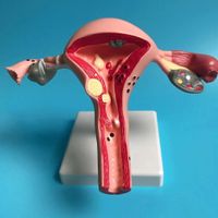 📌 NEU Gebärmutter Anatomisches Modell
