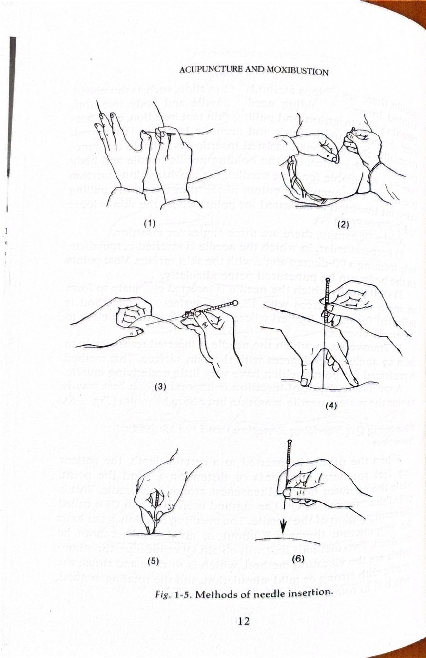 Libri: Acupuncture and Moxibustion – Nuovo (secondo la descrizione) da Sarnen venduto da Livres 5