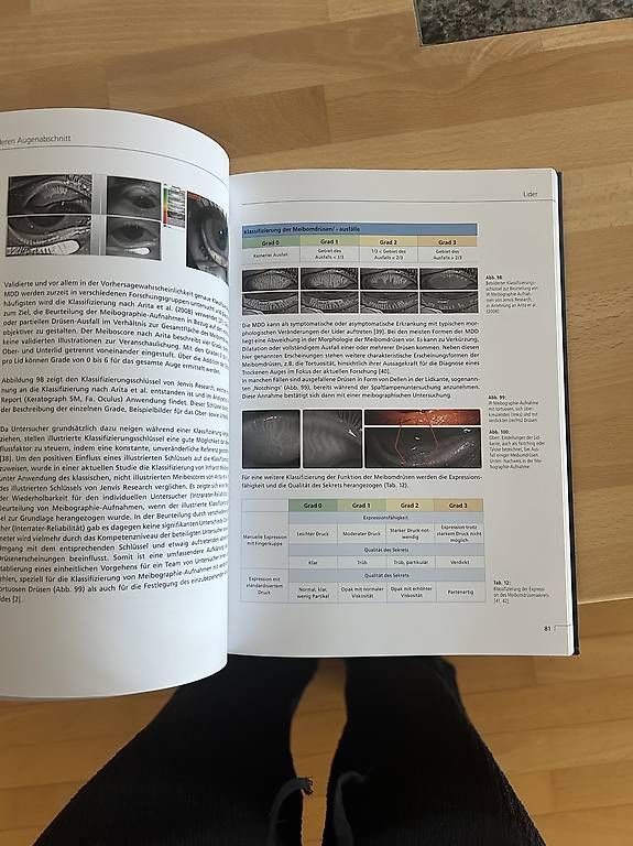 Livres: Optik: Spaltlampenbefunde – D'occasion à St. Gallen par mar_fl6v 2