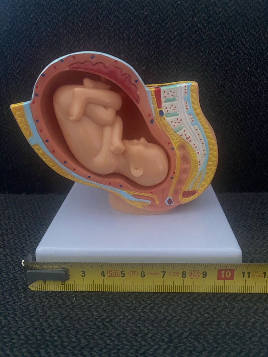 Kit di modellismo & Modellini statici: Anatomie Modell: Gebärmutter mit Fötus - Top Zustand! – Nuovo (secondo la descrizione) da Berikon venduto da Samurai67ch 4