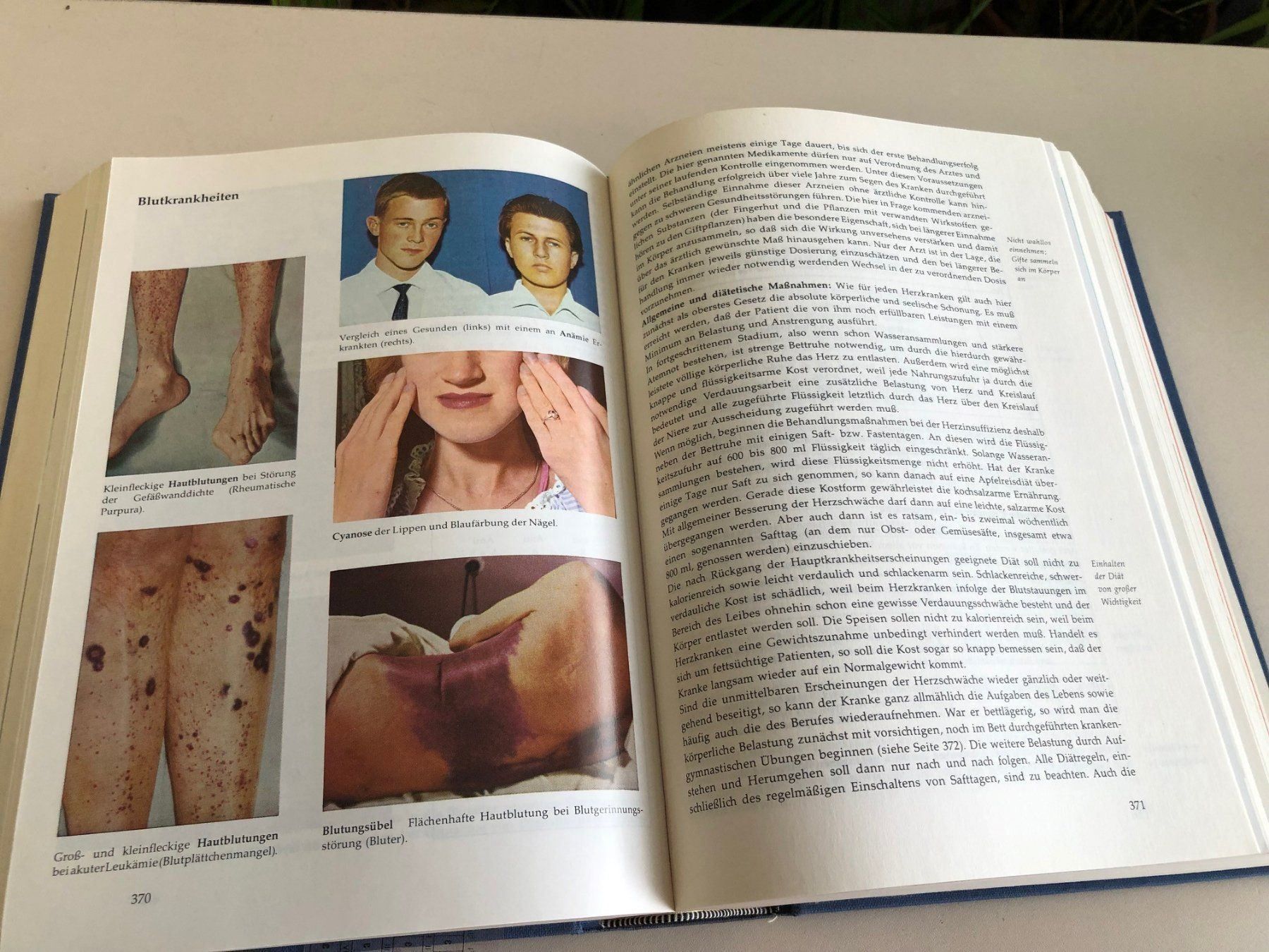 Libri: Gesundheitsbuch Reader's Digest ! – Usato da Brügg BE venduto da rutschimedizin 1