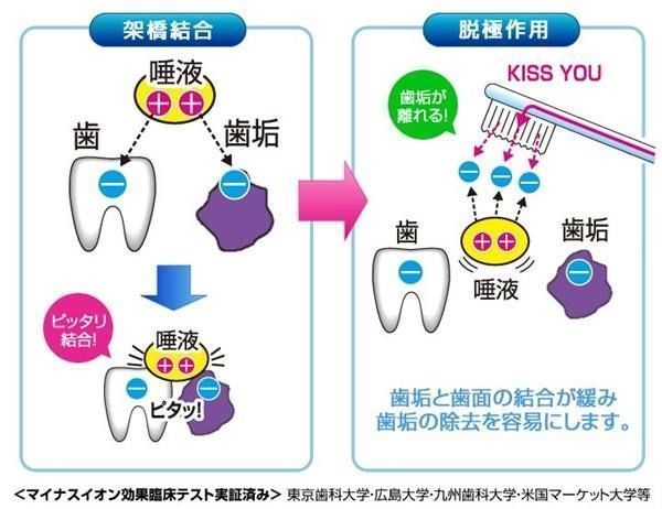 Cura dei denti: Ionen Zahnbürste mit flachem Bürstenkopf – Nuovo e nell'imballaggio originale da Zug venduto da Xylitquelle 1