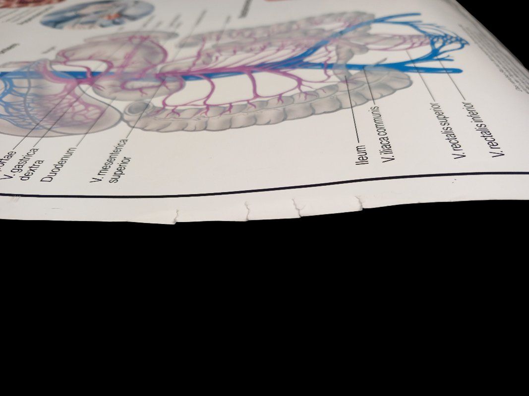 Foto & Immagini: Verdauungsorgane & Hormonsystem Plakat – Usato da Hünenberg venduto da Restwert_Zug 5